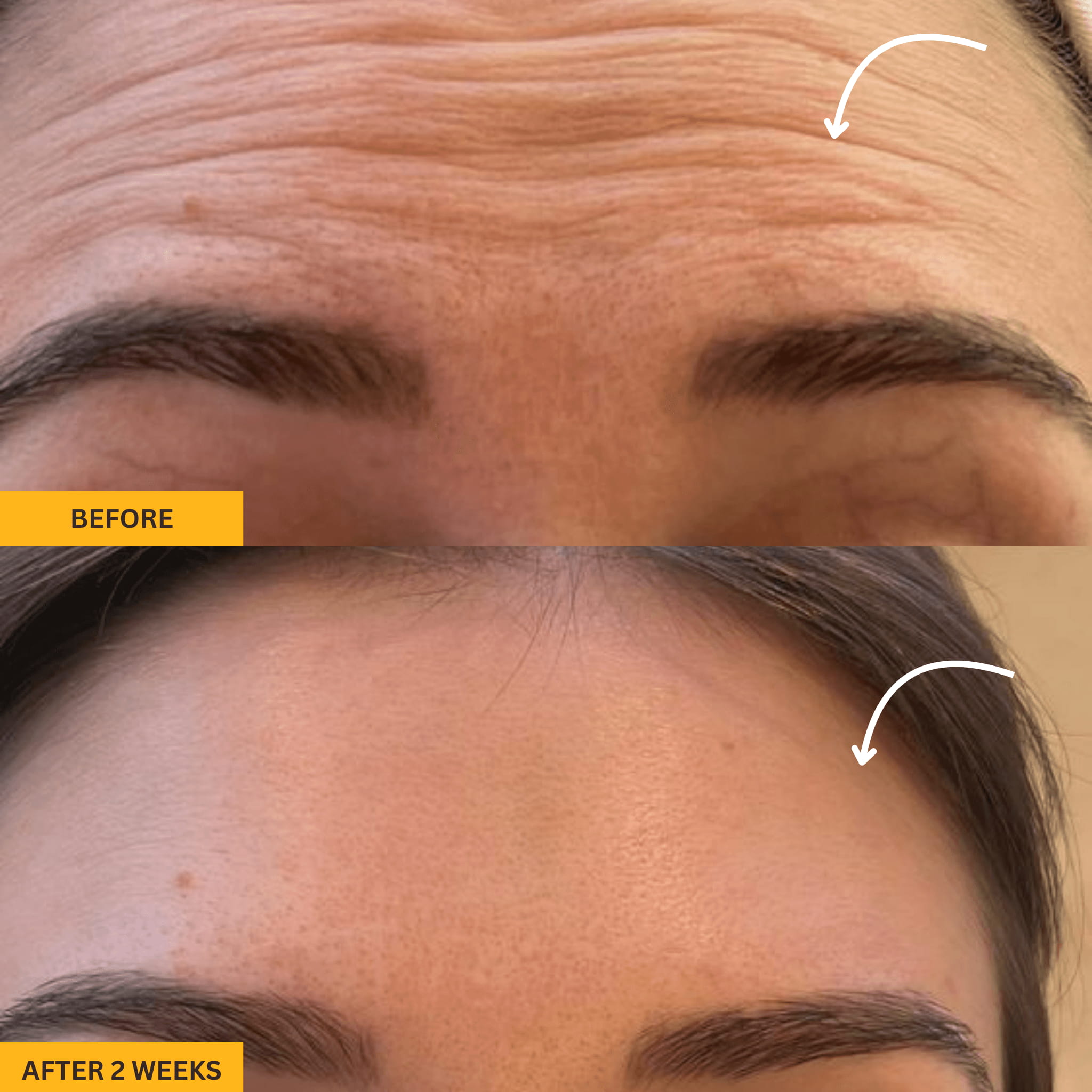 Gua Sha Brush for Snatched Face